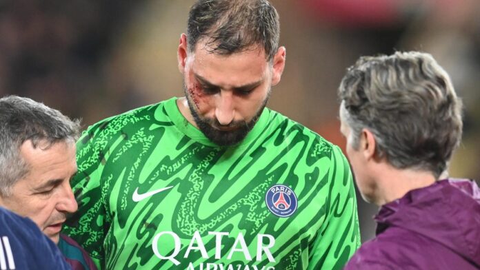 2024-12-18T204403Z_101281342_UP1EKCI1LLE1U_RTRMADP_3_SOCCER-FRANCE-ASM-PSG-REPORT.JPG
